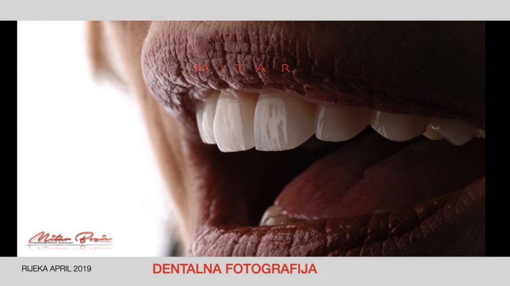 Dentalna fotografija 039
